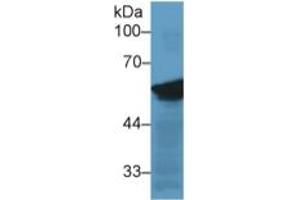 Mouse Capture antibody from the kit in WB with Positive Control: Sample Human Hela cell lysate. (Vimentin Kit ELISA)