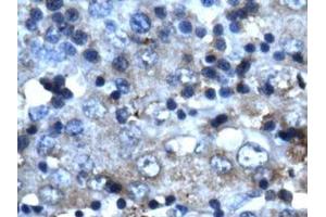Image no. 1 for anti-Cyclin-Dependent Kinase 2 (CDK2) (C-Term) antibody (ABIN202994)