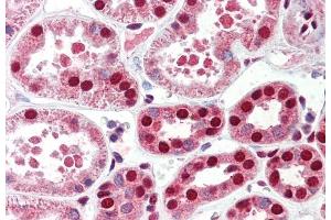 anti-Chromosome 22 Open Reading Frame 28 (C22orf28) (AA 125-138) antibody