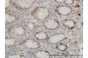 Immunoperoxidase of monoclonal antibody to TRIB2 on formalin-fixed paraffin-embedded human colon. (TRIB2 anticorps  (AA 254-343))