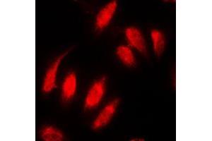 Immunofluorescent analysis of Topoisomerase 2 alpha staining in MDAMB231 cells. (Topoisomerase II alpha anticorps  (N-Term))