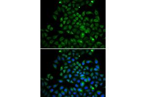 Immunofluorescence analysis of A549 cell using FABP4 antibody. (FABP4 anticorps  (AA 1-132))