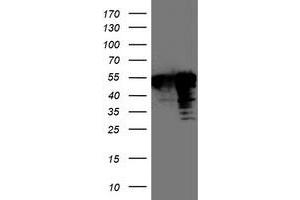 Western Blotting (WB) image for anti-T-Cell Acute Lymphocytic Leukemia 1 (TAL1) antibody (ABIN1501294) (TAL1 anticorps)