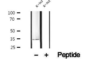 Western blot analysis of extracts of K-562 cells, using PDHB antibody.