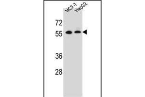 MGAT2 anticorps  (C-Term)