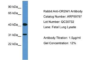WB Suggested Anti-OR2W1  Antibody Titration: 0. (OR2W1 anticorps  (C-Term))