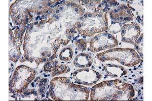 Image no. 2 for anti-Catenin (Cadherin-Associated Protein), beta 1, 88kDa (CTNNB1) antibody (ABIN1496890) (CTNNB1 anticorps)