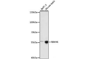 Western blot analysis of extracts of various cell lines using RBM46 Polyclonal Antibody at dilution of 1:1000. (RBM46 anticorps)
