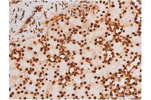 ABIN6267604 at 1/200 staining Mouse kidney tissue sections by IHC-P.