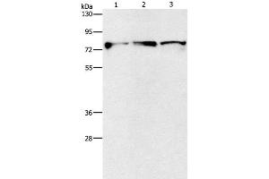 Western Blot analysis of Mouse brain and Human fetal brain tissue, Human brain malignant glioma tissue using KIF3A Polyclonal Antibody at dilution of 1:500 (KIF3A anticorps)