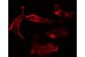 ABIN6266972 staining HT29 cells by IF/ICC.