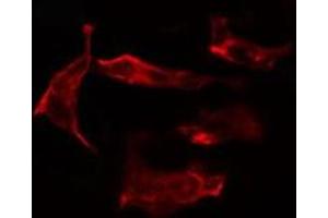 ABIN6266972 staining HT29 cells by IF/ICC. (CYP2J2 anticorps  (Internal Region))