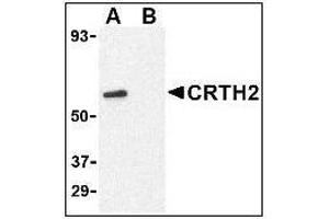 Western blot analysis of CRTH2 in Jurkat cell lysate with at 1 µg/ml in (A) the absence and (B) presence of blocking peptide. (Prostaglandin D2 Receptor 2 (PTGDR2) (N-Term) anticorps)