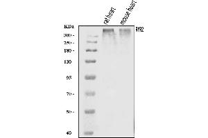 Western blot analysis of RYR2 using anti-RYR2 antibody (ABIN7601440).