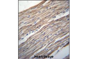 HRC Antibody (Center) (ABIN656657 and ABIN2845898) immunohistochemistry analysis in formalin fixed and paraffin embedded human heart tissue followed by peroxidase conjugation of the secondary antibody and DAB staining.