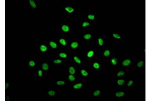 Immunofluorescence staining of Hela Cells with ABIN7127643 at 1:50, counter-stained with DAPI.