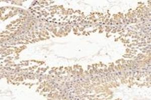 Immunohistochemistry analysis of paraffin-embedded rat testis using,RHOBTB3 (ABIN7075422) at dilution of 1: 3600 (RHOBTB3 anticorps)