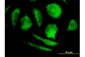 Immunofluorescence of purified MaxPab antibody to PPP5C on HeLa cell. (PP5 anticorps  (AA 1-499))