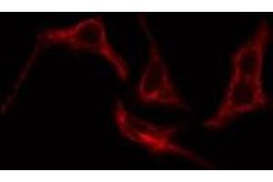 ABIN6276205 staining Hela cells by IF/ICC. (Prostacyclin Receptor anticorps  (Internal Region))