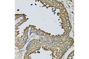Immunohistochemistry of paraffin-embedded human prostate using MYL1 antibody. (MYL1 anticorps  (AA 1-150))