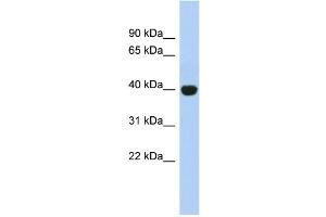 WB Suggested Anti-KIAA1191 Antibody Titration: 0. (KIAA1191 anticorps  (Middle Region))