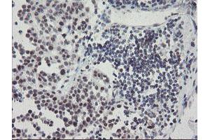 Image no. 5 for anti-SUMO1/sentrin/SMT3 Specific Peptidase 2 (SENP2) (AA 139-523) antibody (ABIN1490931) (SENP2 anticorps  (AA 139-523))