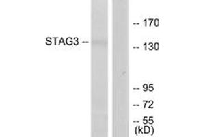 Western blot analysis of extracts from Jurkat cells, using STAG3 Antibody. (STAG3 anticorps  (AA 1161-1210))