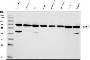 Western blot analysis of PRDM14 using anti-PRDM14 antibody (ABIN7603152).