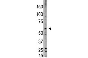 Image no. 1 for anti-Bone Morphogenetic Protein 6 (BMP6) (N-Term) antibody (ABIN357184) (BMP6 anticorps  (N-Term))