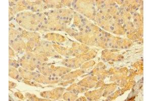Immunohistochemistry of paraffin-embedded human pancreatic tissue using ABIN7174731 at dilution of 1:100 (PARP11 anticorps  (AA 1-245))