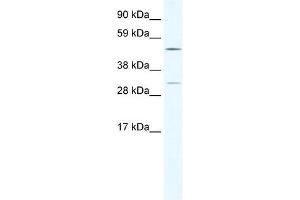 WB Suggested Anti-CAMK4 Antibody Titration:  2. (CAMK4 anticorps  (C-Term))