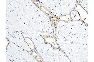 IHC analysis of ANXA3 using anti-ANXA3 antibody (ABIN6719269). (Annexin A3 anticorps  (AA 23-323))