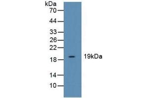 Detection of CFL1 in Human Liver Tissue using Polyclonal Antibody to Cofilin 1 (CFL1) (Cofilin anticorps  (AA 3-161))