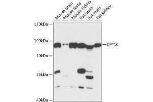 Western blot analysis of extracts of various cell lines, using CPT1C antibody (ABIN6130131, ABIN6138980, ABIN6138981 and ABIN6217987) at 1:3000 dilution. (CPT1C anticorps  (AA 270-400))