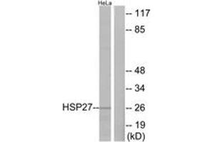 Western blot analysis of extracts from HeLa cells, treated with Ca2+, using HSP27 (Ab-82) Antibody. (HSP27 anticorps  (AA 48-97))