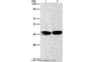 Western blot analysis of Hela cell and mouse kidney tissue, using ADPRHL2 Polyclonal Antibody at dilution of 1:500