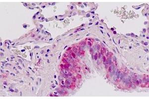 Human Lung, Respiratory Epithelium: Formalin-Fixed, Paraffin-Embedded (FFPE) (IGFBP2 anticorps  (AA 277-305))