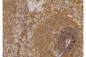 ABIN6258774 and ABIN6274538 at 1/100 staining Rat spleen tissue by IHC-P. (EPH Receptor A6 anticorps  (C-Term))