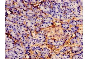 Immunocytochemistry analysis of human pancreatic tissue using ABIN7156203 at dilution of 1:100 (Indian Hedgehog anticorps  (AA 203-411))