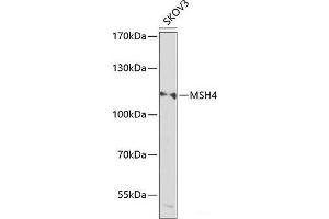 Western blot analysis of extracts of SKOV3 cells using MSH4 Polyclonal Antibody at dilution of 1:1000. (MSH4 anticorps)