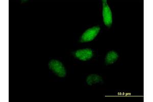 Immunofluorescence of purified MaxPab antibody to ELF2 on HeLa cell. (ELF2 anticorps  (AA 1-581))