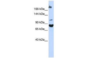 FBXO11 antibody used at 1 ug/ml to detect target protein.