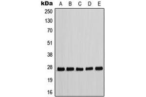 Western blot analysis of p27 Kip1 (pT198) expression in HEK293T EGF-treated (A), MCF7 (B), NIH3T3 (C), Raw264.
