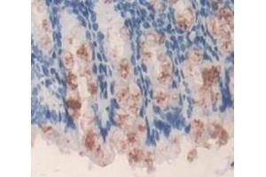 IHC-P analysis of Mouse Tissue, with DAB staining. (ACAT1 anticorps  (AA 31-424))