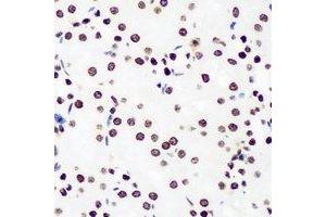 Immunohistochemical analysis of DDX41 staining in rat kidney formalin fixed paraffin embedded tissue section. (DDX41 anticorps)