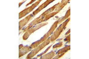 SLC16A10 Antibody (C-term) (ABIN657159 and ABIN2846293) immunohistochemistry analysis in formalin fixed and paraffin embedded human skeletal muscle followed by peroxidase conjugation of the secondary antibody and DAB staining. (SLC16A10 anticorps  (C-Term))