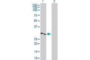 Lane 1: ATF2 transfected lysate ( 23. (ATF2 293T Cell Transient Overexpression Lysate(Denatured))