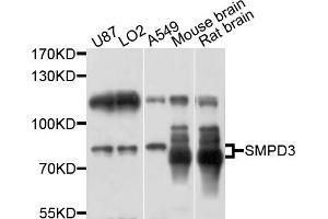 Western blot analysis of extracts of various cell lines, using SMPD3 antibody (ABIN6003882) at 1/1000 dilution. (SMPD3 anticorps)