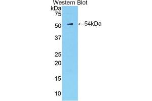 Western blot analysis of the recombinant protein. (Kallikrein 6 anticorps  (AA 19-261))