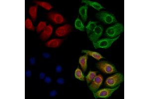 ABIN6260213 and ABIN6273093 staining Hela cells by IF/ICC.